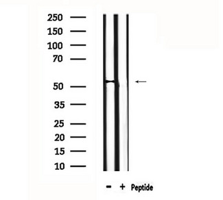 DUSP10 / MKP5 Antibody - Western blot analysis of extracts of rat spleen using DUSP10 antibody.