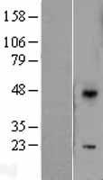 DUSP10 / MKP5 Protein - Western validation with an anti-DDK antibody * L: Control HEK293 lysate R: Over-expression lysate