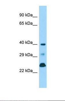 DUSP11 Antibody - Western blot of Mouse Testis. Dusp11 antibody dilution 1.0 ug/ml.  This image was taken for the unconjugated form of this product. Other forms have not been tested.