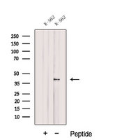 DUSP11 Antibody - Western blot analysis of extracts of K562 cells using DUSP11 antibody. The lane on the left was treated with blocking peptide.
