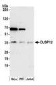 DUSP12 Antibody - Detection of human DUSP12 by western blot. Samples: Whole cell lysate (15 µg) from HeLa, HEK293T, and Jurkat cells prepared using NETN lysis buffer. Antibody: Affinity purified rabbit anti-DUSP12 antibody used for WB at 1:1000. Detection: Chemiluminescence with an exposure time of 3 minutes.