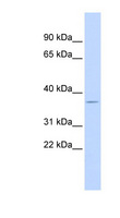 DUSP12 Antibody - DUSP12 / GKAP antibody Western blot of Fetal Heart lysate. This image was taken for the unconjugated form of this product. Other forms have not been tested.