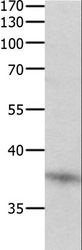 DUSP12 Antibody - Western blot analysis of Jurkat cell, using DUSP12 Polyclonal Antibody at dilution of 1:500.