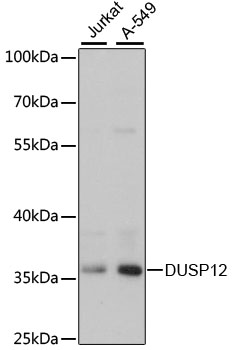 DUSP12 Antibody - Western blot analysis of extracts of various cell lines, using DUSP12 antibody at 1:3000 dilution. The secondary antibody used was an HRP Goat Anti-Rabbit IgG (H+L) at 1:10000 dilution. Lysates were loaded 25ug per lane and 3% nonfat dry milk in TBST was used for blocking. An ECL Kit was used for detection and the exposure time was 30s.