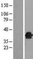 DUSP12 Protein - Western validation with an anti-DDK antibody * L: Control HEK293 lysate R: Over-expression lysate