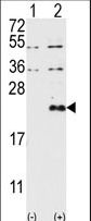 DUSP13 Antibody - Western blot of DUSP13 (arrow) using DUSP13-M1 Antibody. 293 cell lysates (2 ug/lane) either nontransfected (Lane 1) or transiently transfected with the DUSP13 gene (Lane 2) (Origene Technologies).