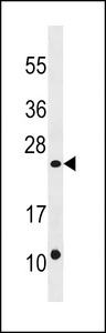 DUSP13 Antibody - DUSP13 Antibody western blot of A2058 cell line lysates (35 ug/lane). The DUSP13 antibody detected the DUSP13 protein (arrow).