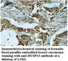 DUSP13 Antibody
