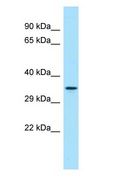 DUSP13 Antibody - DUSP13 antibody Western Blot of Fetal Lung.  This image was taken for the unconjugated form of this product. Other forms have not been tested.