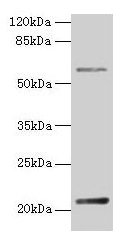 DUSP13 Antibody - Western Blot Positive WB detected in: Rat skeletal muscle tissue, Mouse spleen tissue All lanes: DUSP13 antibody at 3.2µg/ml Secondary Goat polyclonal to rabbit IgG at 1/50000 dilution Predicted band size: 21, 23 kDa Observed band size: 21 kDa