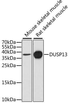DUSP13 Antibody - Western blot analysis of extracts of various cell lines using DUSP13 Polyclonal Antibody at dilution of 1:1000.