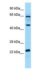 DUSP14 Antibody - DUSP14 antibody Western Blot of Placenta.  This image was taken for the unconjugated form of this product. Other forms have not been tested.
