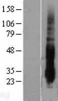 DUSP14 Protein - Western validation with an anti-DDK antibody * L: Control HEK293 lysate R: Over-expression lysate