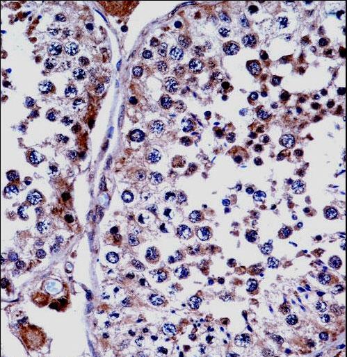 DUSP15 Antibody - DUSP15 Antibody immunohistochemistry of formalin-fixed and paraffin-embedded human testis tissue followed by peroxidase-conjugated secondary antibody and DAB staining.