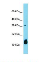 DUSP15 Antibody - Western blot of Mouse Kidney. Dusp15 antibody dilution 1.0 ug/ml.  This image was taken for the unconjugated form of this product. Other forms have not been tested.