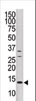 DUSP15 Antibody - Western blot of anti-DUSP15 antibody in CEM cell line tissue lysate (35 ug/lane). DUSP15(arrow) was detected using the purified antibody.