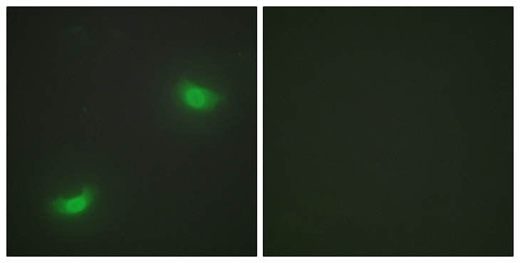 DUSP16 / MKP7 Antibody - Immunofluorescence analysis of HepG2 cells, using DUSP16 Antibody. The picture on the right is blocked with the synthesized peptide.