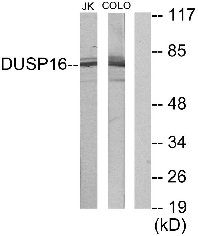DUSP16 / MKP7 Antibody - Western blot analysis of lysates from Jurkat and COLO205 cells, using DUSP16 Antibody. The lane on the right is blocked with the synthesized peptide.