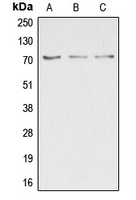DUSP16 / MKP7 Antibody - Western blot analysis of DUSP16 expression in HepG2 (A); COLO205 (B); HEK293T (C) whole cell lysates.