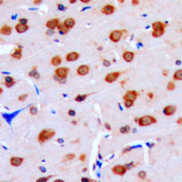 DUSP16 / MKP7 Antibody - Immunohistochemical analysis of DUSP16 staining in human brain formalin fixed paraffin embedded tissue section. The section was pre-treated using heat mediated antigen retrieval with sodium citrate buffer (pH 6.0). The section was then incubated with the antibody at room temperature and detected using an HRP conjugated compact polymer system. DAB was used as the chromogen. The section was then counterstained with hematoxylin and mounted with DPX.