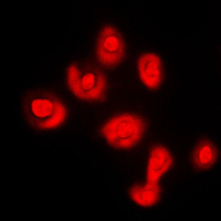DUSP16 / MKP7 Antibody - Immunofluorescent analysis of DUSP16 staining in COLO205 cells. Formalin-fixed cells were permeabilized with 0.1% Triton X-100 in TBS for 5-10 minutes and blocked with 3% BSA-PBS for 30 minutes at room temperature. Cells were probed with the primary antibody in 3% BSA-PBS and incubated overnight at 4 C in a humidified chamber. Cells were washed with PBST and incubated with a DyLight 594-conjugated secondary antibody (red) in PBS at room temperature in the dark. DAPI was used to stain the cell nuclei (blue).
