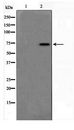 DUSP16 / MKP7 Antibody - Western blot of Jurkat cell lysate using DUSP16 Antibody