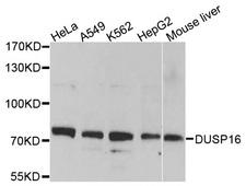 DUSP16 / MKP7 Antibody - Western blot analysis of extracts of various cell lines, using DUSP16 antibody at 1:1000 dilution. The secondary antibody used was an HRP Goat Anti-Rabbit IgG (H+L) at 1:10000 dilution. Lysates were loaded 25ug per lane and 3% nonfat dry milk in TBST was used for blocking. An ECL Kit was used for detection and the exposure time was 90s.