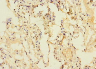 DUSP16 / MKP7 Antibody - Immunohistochemistry of paraffin-embedded human lung tissue at dilution 1:100