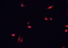 DUSP16 / MKP7 Antibody - Staining MCF-7 cells by IF/ICC. The samples were fixed with PFA and permeabilized in 0.1% Triton X-100, then blocked in 10% serum for 45 min at 25°C. The primary antibody was diluted at 1:200 and incubated with the sample for 1 hour at 37°C. An Alexa Fluor 594 conjugated goat anti-rabbit IgG (H+L) antibody, diluted at 1/600, was used as secondary antibody.