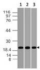 DUSP18 Antibody - Fig-1: Western blot analysis of DUSP18. Anti-DUSP18 antibody was used at 0.5 µg/ml on (1) h Brain, (2) h Liver and (3) h Kidney lysates.