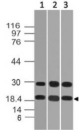 DUSP18 Antibody - Fig-2: Western blot analysis of DUSP18. Anti-DUSP18 antibody was used at 0.5 µg/ml on (1) m Liver, (2) r Liver and (3) m Kidney lysates.