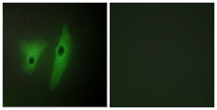 DUSP19 / SKRP1 Antibody - Immunofluorescence analysis of HeLa cells, using DUSP19 Antibody. The picture on the right is blocked with the synthesized peptide.