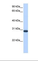 DUSP19 / SKRP1 Antibody - Fetal muscle cell lysate. Antibody concentration: 1.0 ug/ml. Gel concentration: 12%.  This image was taken for the unconjugated form of this product. Other forms have not been tested.