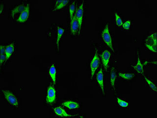 DUSP19 / SKRP1 Antibody - Immunofluorescent analysis of Hela cells using DUSP19 Antibody at dilution of 1:100 and Alexa Fluor 488-congugated AffiniPure Goat Anti-Rabbit IgG(H+L)