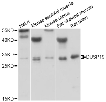 DUSP19 / SKRP1 Antibody - Western blot analysis of extracts of various cell lines.