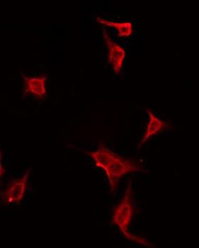 DUSP19 / SKRP1 Antibody - Staining HeLa cells by IF/ICC. The samples were fixed with PFA and permeabilized in 0.1% Triton X-100, then blocked in 10% serum for 45 min at 25°C. The primary antibody was diluted at 1:200 and incubated with the sample for 1 hour at 37°C. An Alexa Fluor 594 conjugated goat anti-rabbit IgG (H+L) Ab, diluted at 1/600, was used as the secondary antibody.