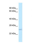 DUSP19 / SKRP1 Antibody - DUSP19 antibody Western blot of Rat Muscle lysate. Antibody concentration 1 ug/ml.  This image was taken for the unconjugated form of this product. Other forms have not been tested.