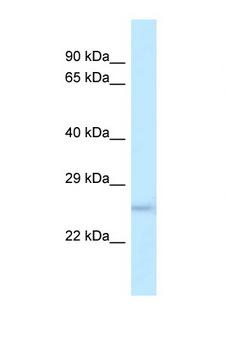 DUSP19 / SKRP1 Antibody - DUSP19 antibody Western blot of Rat Muscle lysate. Antibody concentration 1 ug/ml.  This image was taken for the unconjugated form of this product. Other forms have not been tested.