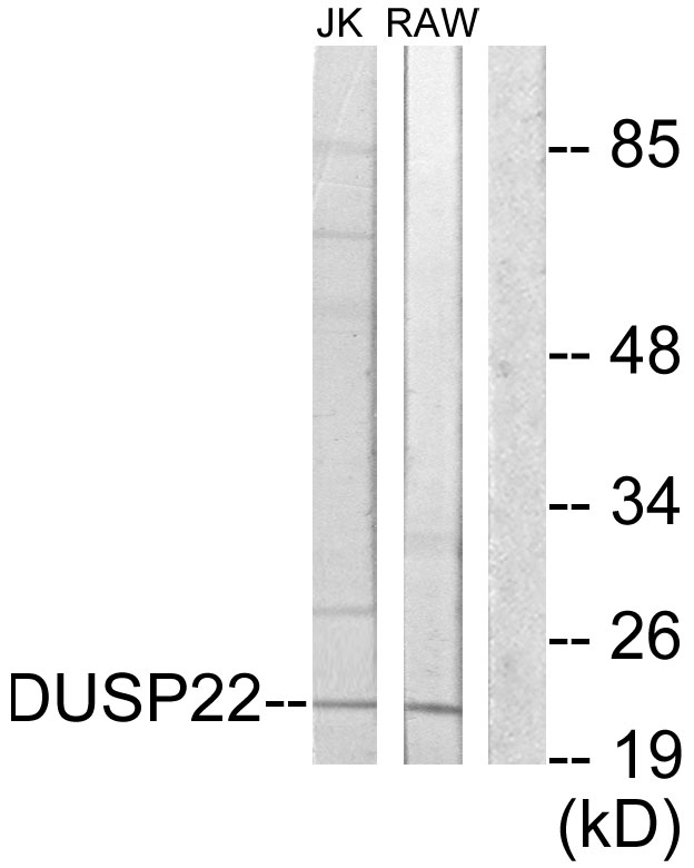 DUSP22 / JSP 1 Antibody - Western blot analysis of lysates from RAW264.7 and Jurkat cells, using DUSP22 Antibody. The lane on the right is blocked with the synthesized peptide.