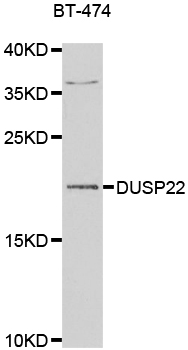 DUSP22 / JSP 1 Antibody - Western blot analysis of extracts of BT-474 cells.