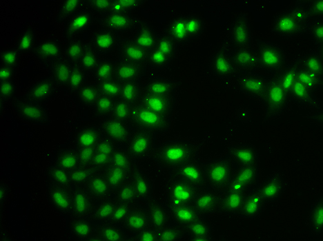 DUSP22 / JSP 1 Antibody - Immunofluorescence analysis of MCF7 cells.