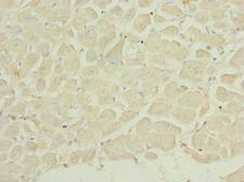 DUSP22 / JSP 1 Antibody - Immunohistochemistry of paraffin-embedded human heart tissue at dilution 1:100