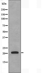 DUSP22 / JSP 1 Antibody - Western blot analysis of extracts of Jurkat cells using DUSP22 antibody.