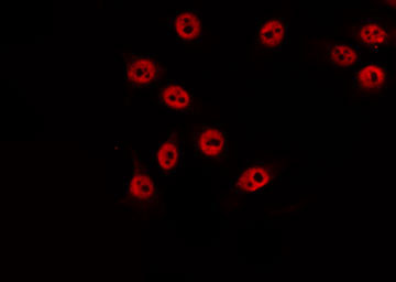 DUSP22 / JSP 1 Antibody - Staining RAW264.7 cells by IF/ICC. The samples were fixed with PFA and permeabilized in 0.1% Triton X-100, then blocked in 10% serum for 45 min at 25°C. The primary antibody was diluted at 1:200 and incubated with the sample for 1 hour at 37°C. An Alexa Fluor 594 conjugated goat anti-rabbit IgG (H+L) Ab, diluted at 1/600, was used as the secondary antibody.