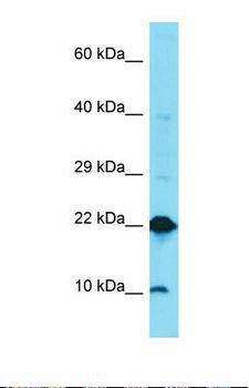 DUSP22 / JSP 1 Antibody - Western blot of Human Thyroid Tumor. DUSP22 antibody dilution 1.0 ug/ml.  This image was taken for the unconjugated form of this product. Other forms have not been tested.