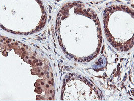 DUSP23 Antibody - IHC of paraffin-embedded Human breast tissue using anti-DUSP23 mouse monoclonal antibody.