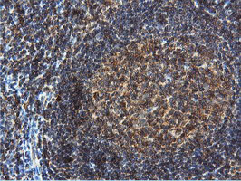 DUSP23 Antibody - IHC of paraffin-embedded Human tonsil using anti-DUSP23 mouse monoclonal antibody.