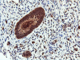 DUSP23 Antibody - IHC of paraffin-embedded Human endometrium tissue using anti-DUSP23 mouse monoclonal antibody.