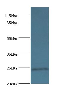 DUSP26 / MKP8 Antibody - Western blot. All lanes: Dual specificity protein phosphatase 26 antibody at 2 ug/ml+mouse brain tissue. Secondary antibody: Goat polyclonal to rabbit at 1:10000 dilution. Predicted band size: 24 kDa. Observed band size: 24 kDa.  This image was taken for the unconjugated form of this product. Other forms have not been tested.