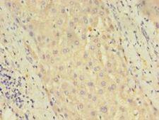 DUSP26 / MKP8 Antibody - Immunohistochemistry of paraffin-embedded human liver tissue using antibody at 1:100 dilution.  This image was taken for the unconjugated form of this product. Other forms have not been tested.